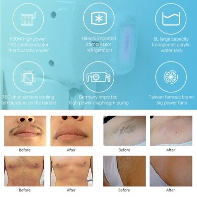 ARESLITE DM50P diode hair removal laser (755+808+1064nm) 3