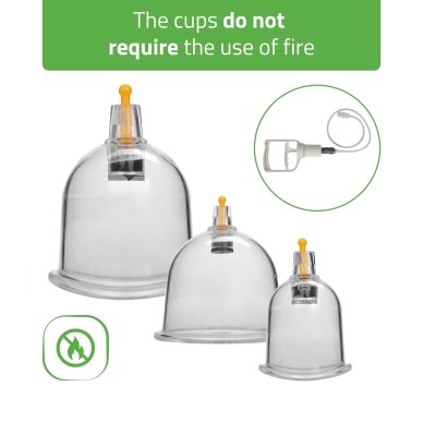 Professional vacuum cup set with pump, 24 pcs. 2