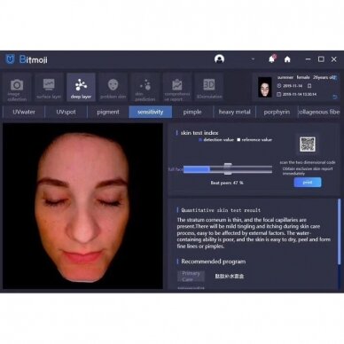 BITMOJI Устройство для диагностики и анализа кожи с 3D модуляцией и 28 миллионов HD-пиксели (с планшетом) 6