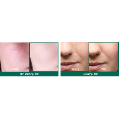 SOMEBYMI AHA-BHA-PHA 30 DAYS serum for problematic facial skin, 50 ml SOMEBYMI AHA-BHA-PHA 30 DAYS serum for problematic facial skin, 50 ml