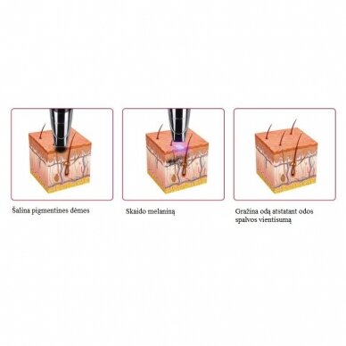 PICOSECOND + CARBON PEELING Tattoo and pigment removal machine 5 PICOSECOND + CARBON PEELING Tattoo and pigment removal machine 5