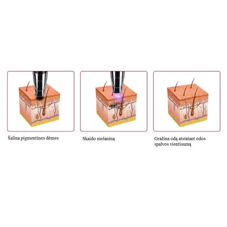 PICOSECOND + CARBON PEELING Tattoo and pigment removal machine 5 PICOSECOND + CARBON PEELING Tattoo and pigment removal machine 5