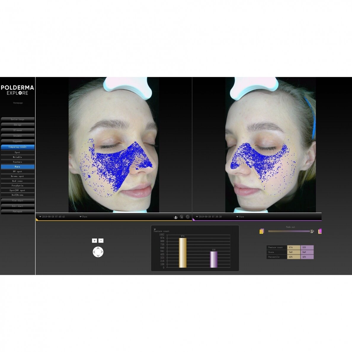 Facial skin analyzer POLDERMA EXPLORE 3D PL 5 Facial skin analyzer POLDERMA EXPLORE 3D PL 5