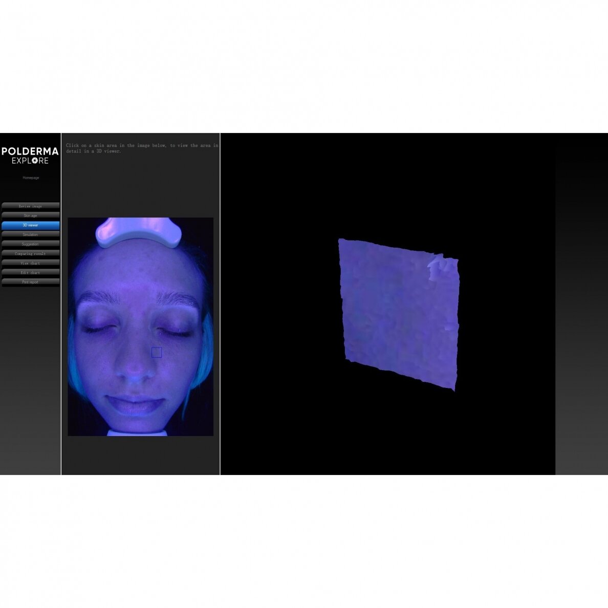 Facial skin analyzer POLDERMA EXPLORE 3D PL 6 Facial skin analyzer POLDERMA EXPLORE 3D PL 6