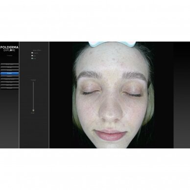 Facial skin analyzer POLDERMA EXPLORE 3D PL 4