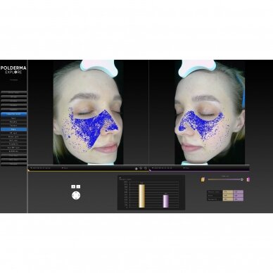 Facial skin analyzer POLDERMA EXPLORE 3D PL 5